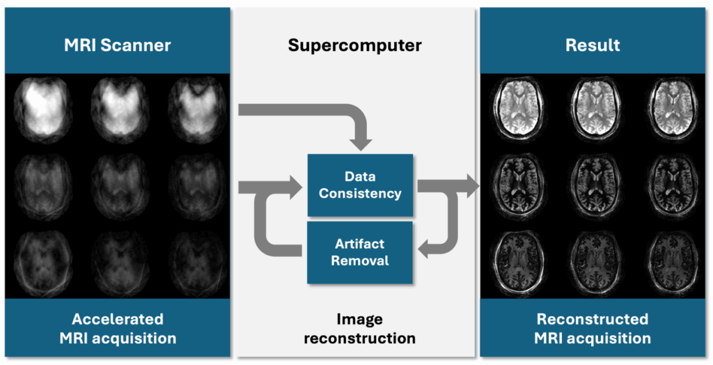 Diagramm zur Verbesserung von MRT-Bildern mit einem Supercomputer.